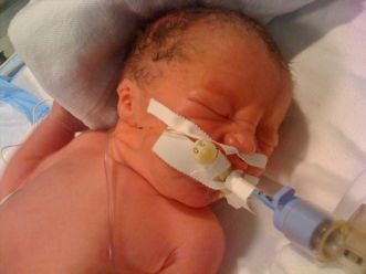 Preemie Health Risks