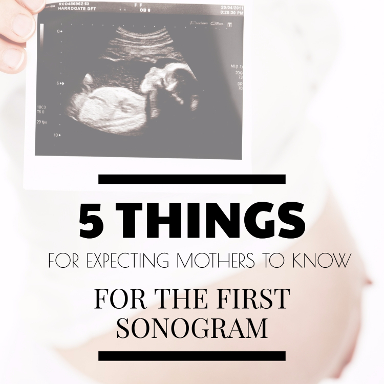 5 Important Things For An Expecting Mother To Know Before Her First Sonogram