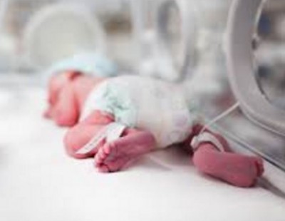 Preemie Babies What Every Mom Needs to Know about their Special Little One