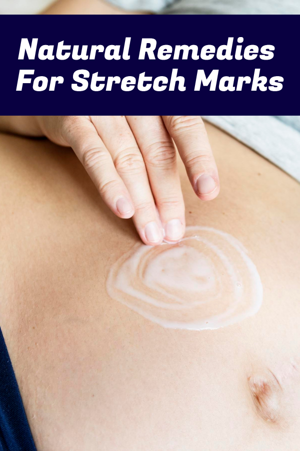 Natural Remedies  For Stretch Marks
