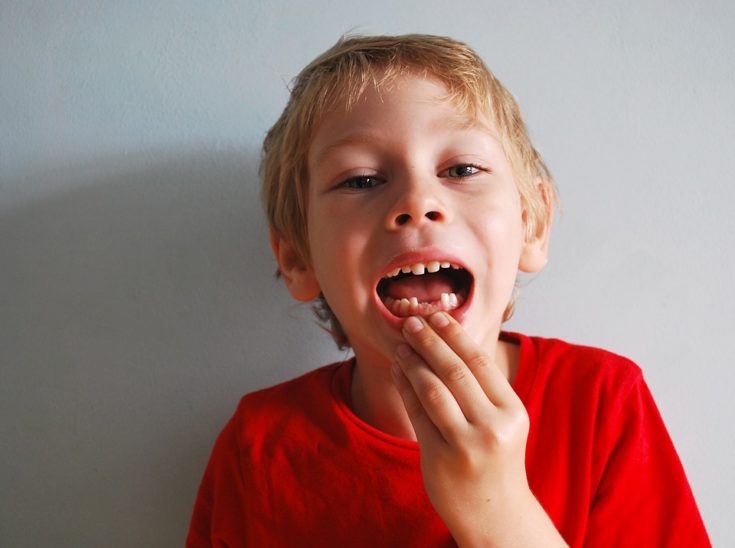 Losing Baby Teeth: Should You Worry if Your Child Seems to Be Late?