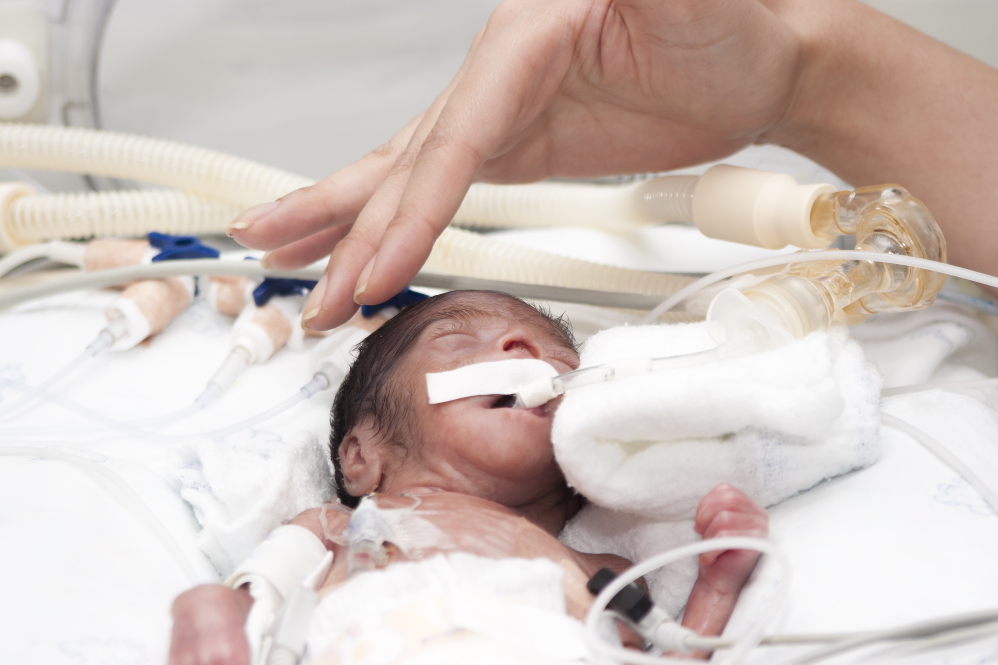 dealing-with-the-effects-of-a-premature-birth-preemie-twins-baby-blog